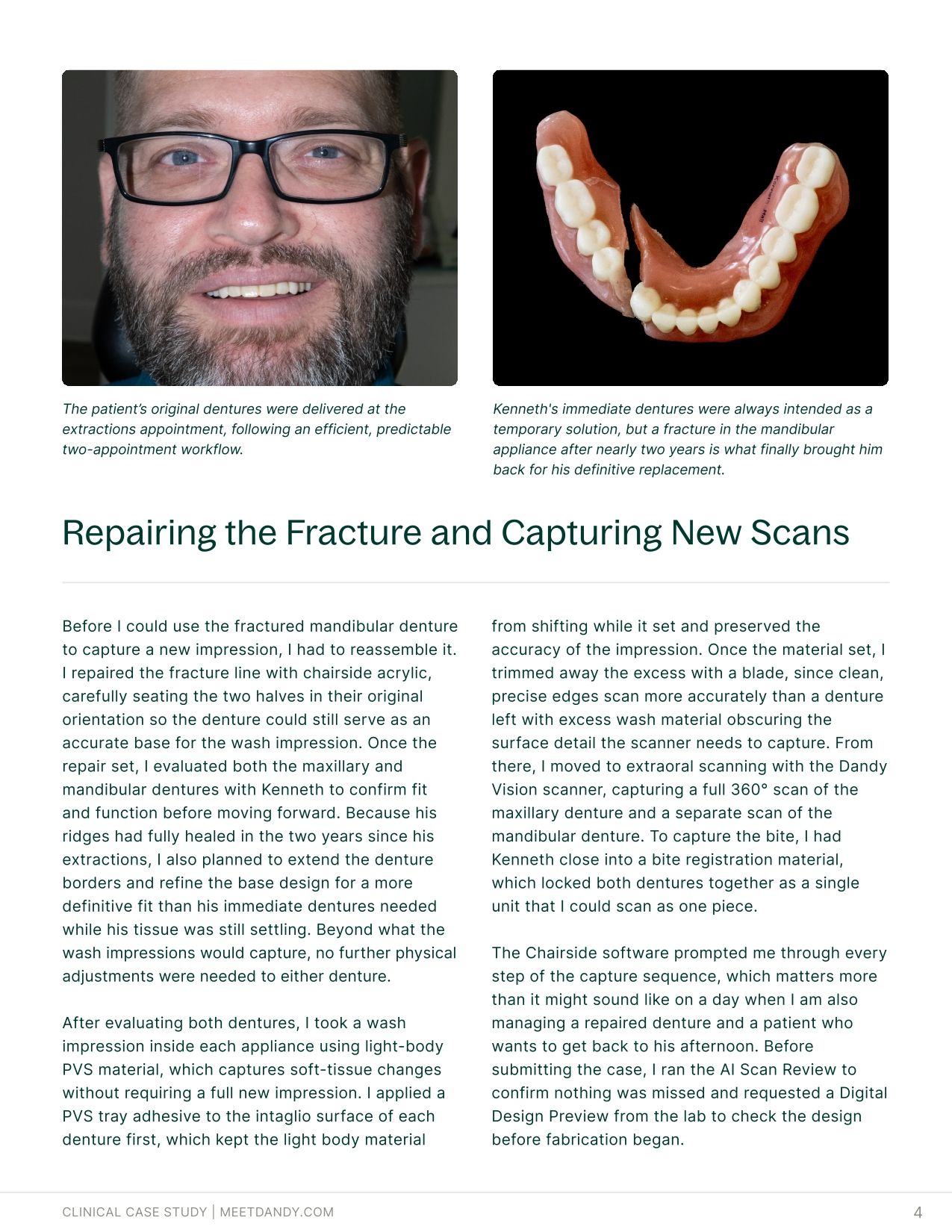Case Study: Fusion Dentures Bring Traditional Acrylic to a Digital Workflow