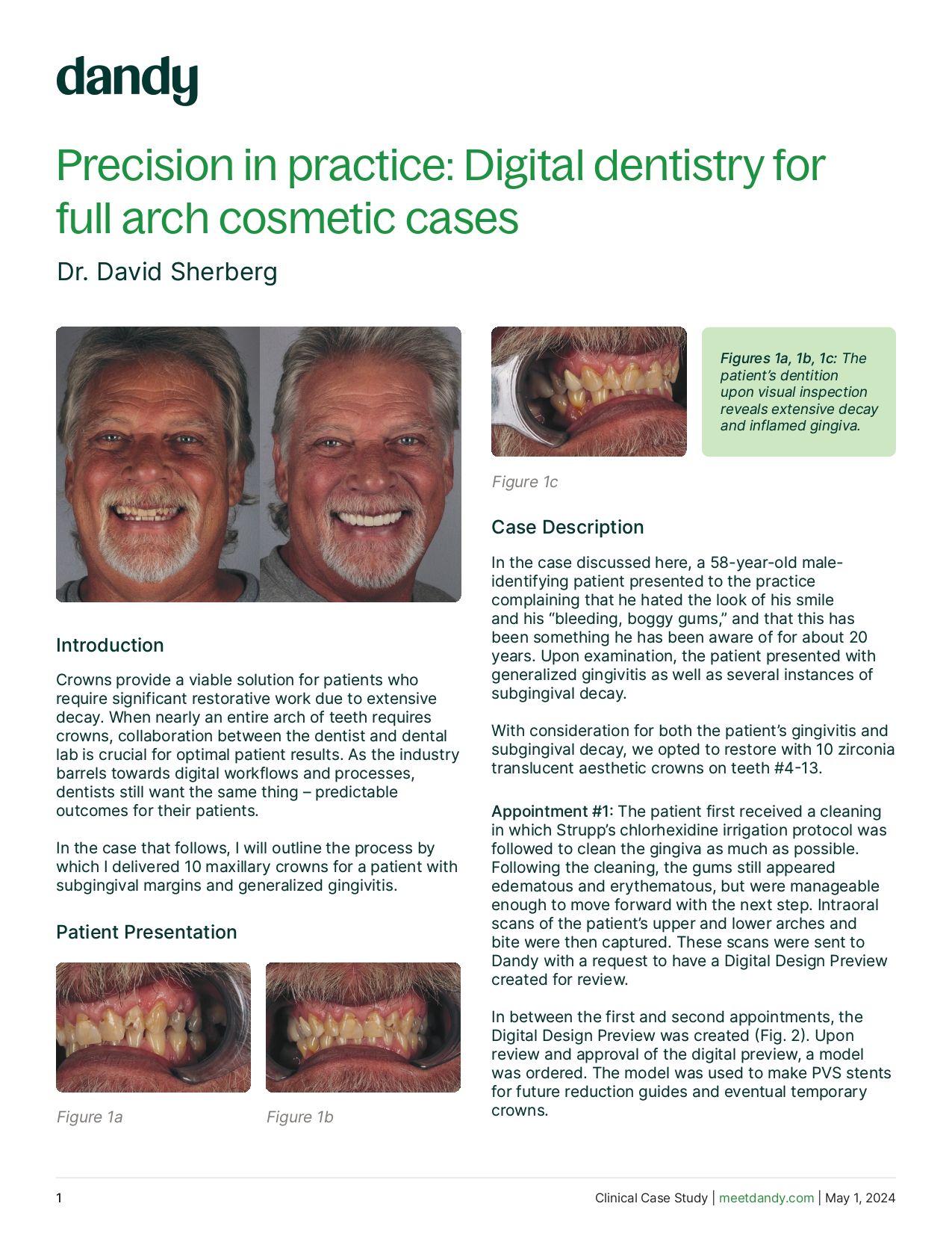 Precision in practice: Digital dentistry for full arch cosmetic cases