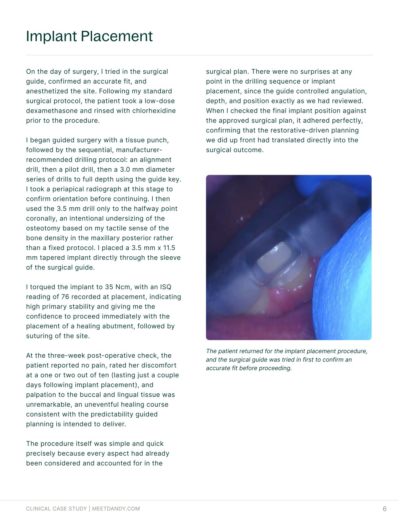 Case Study: Surgical Guides with Dr. Haley