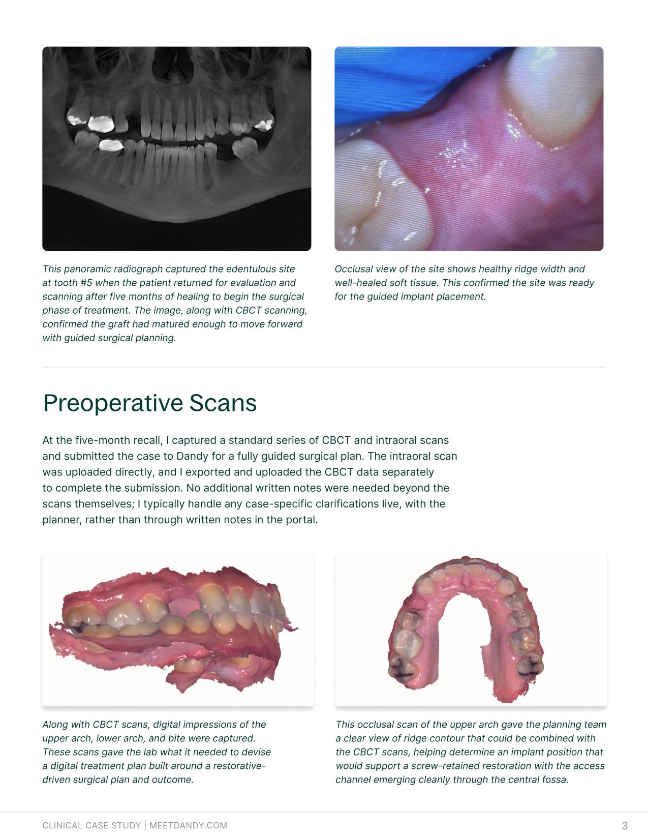 Case Study: Surgical Guides with Dr. Haley