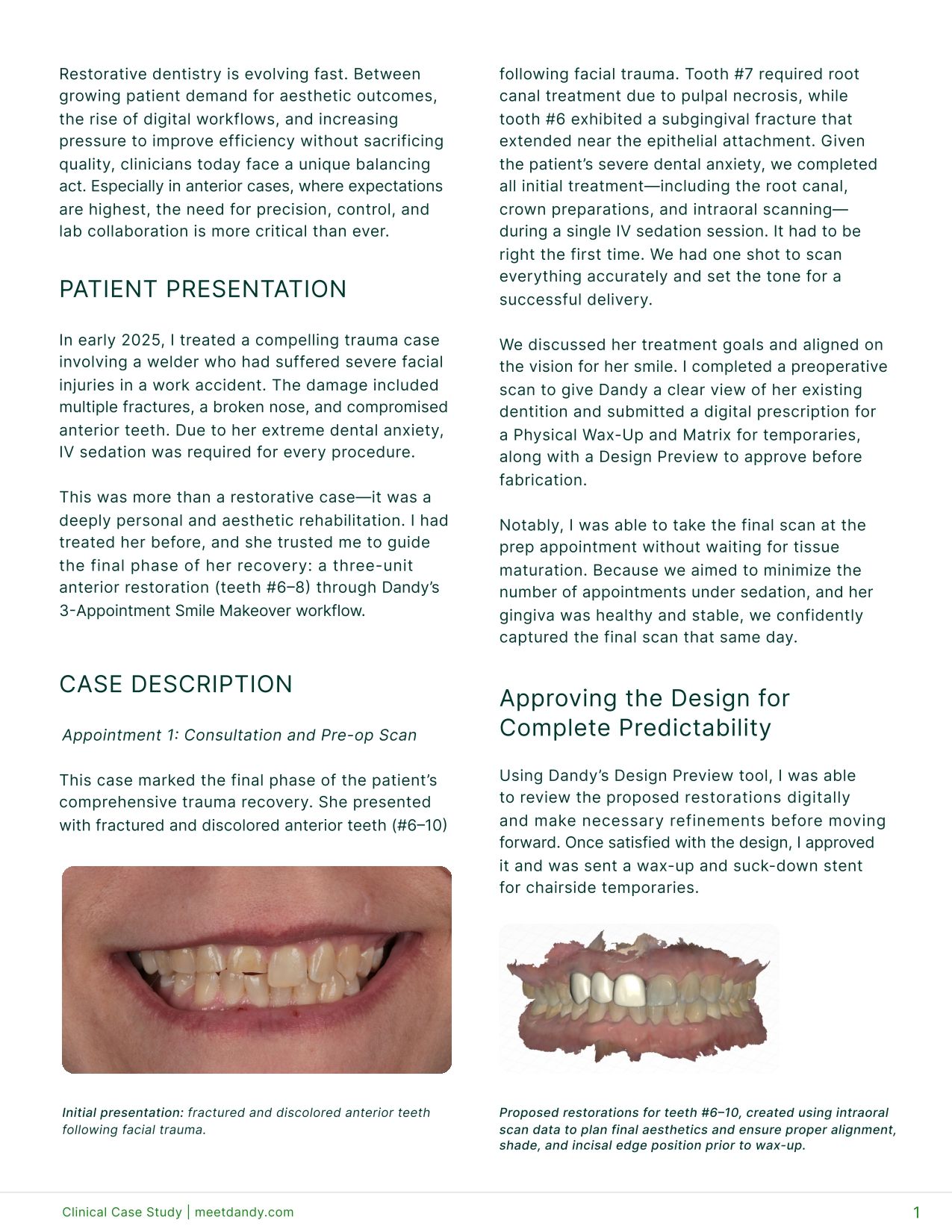 Restoring Anterior Aesthetics After Trauma