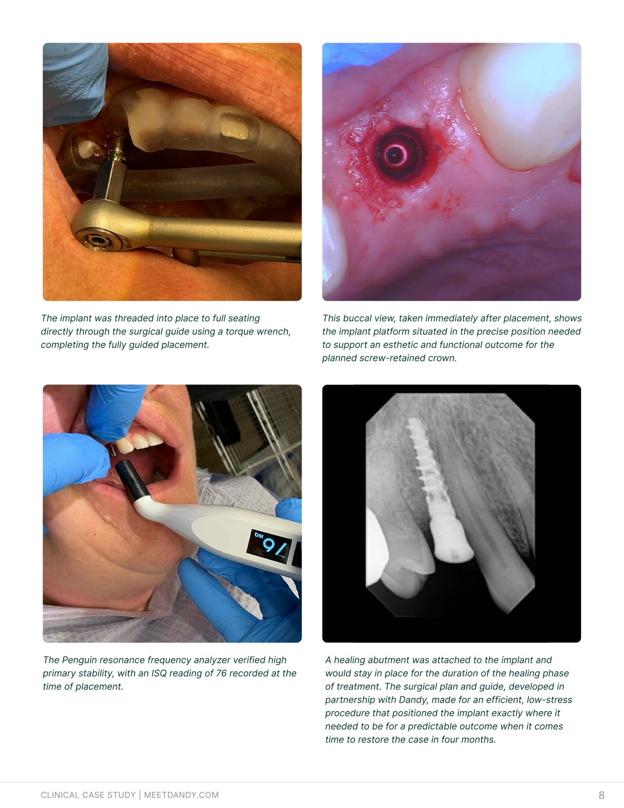Case Study: Surgical Guides with Dr. Haley