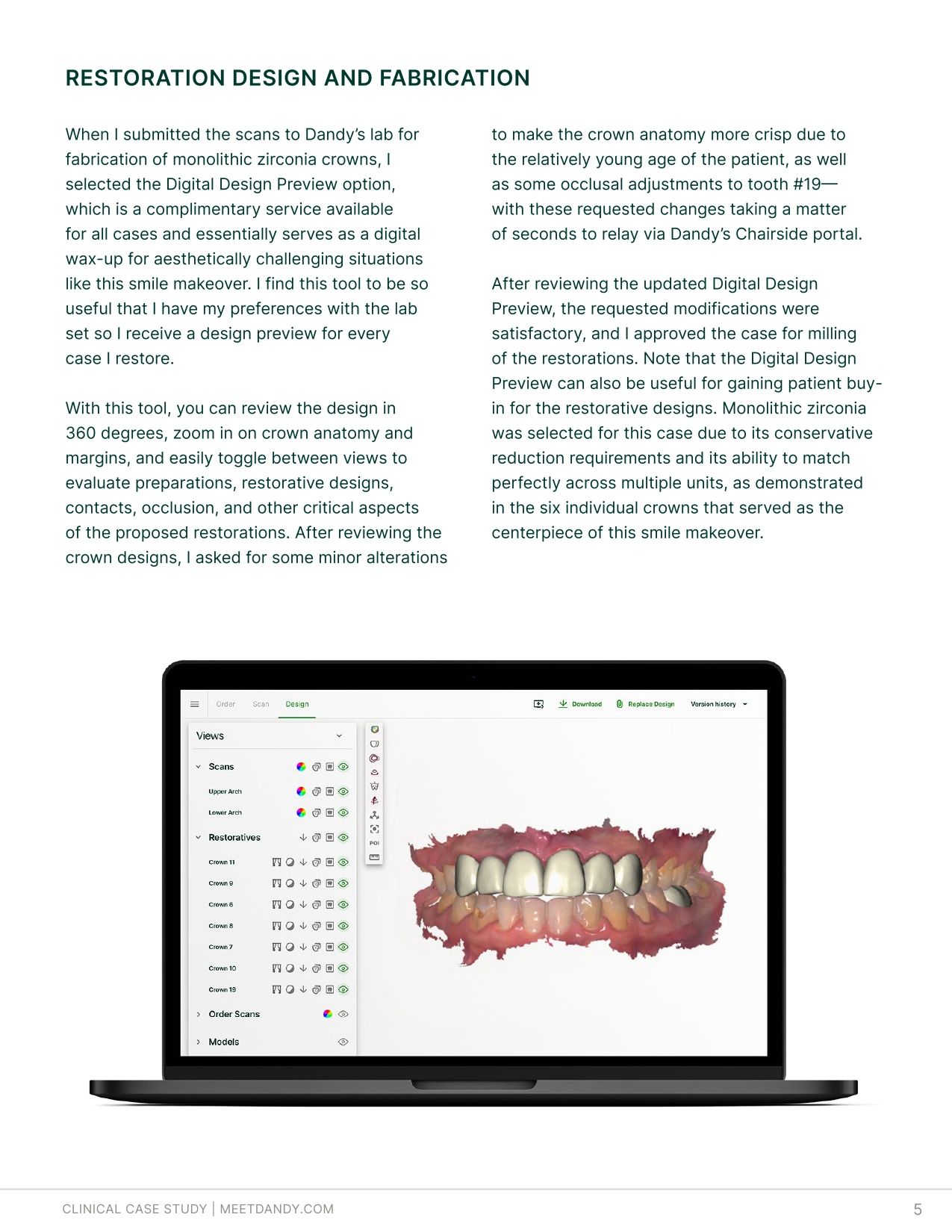 Case Study: Simplifying Smile Makeovers with Digital