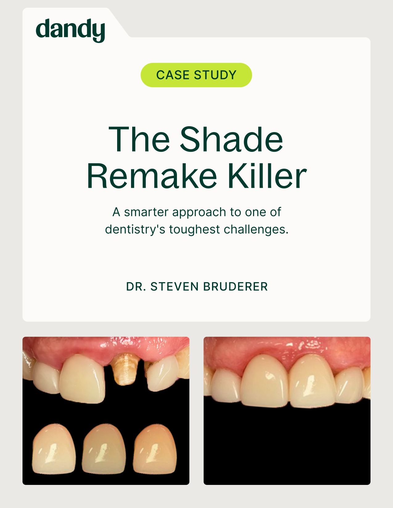 The Shade Remake Killer