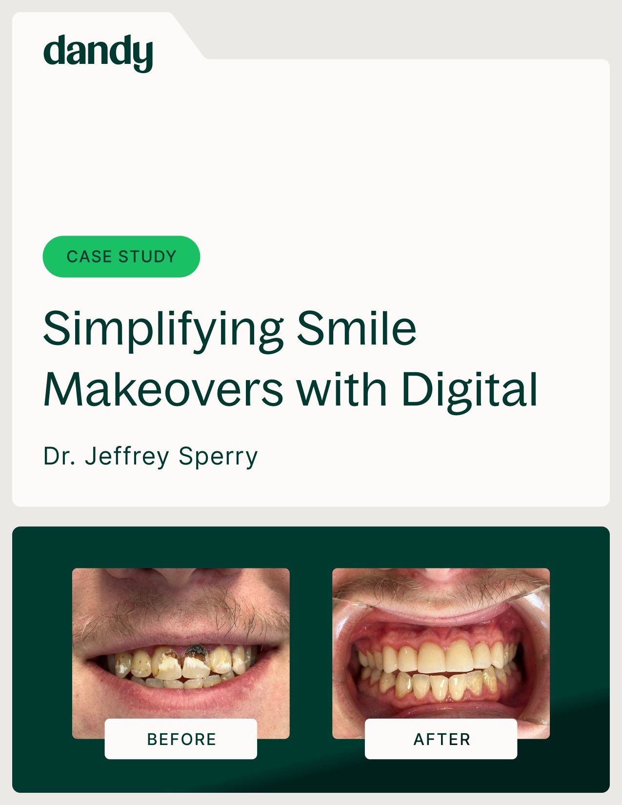 Case Study: Simplifying Smile Makeovers with Digital