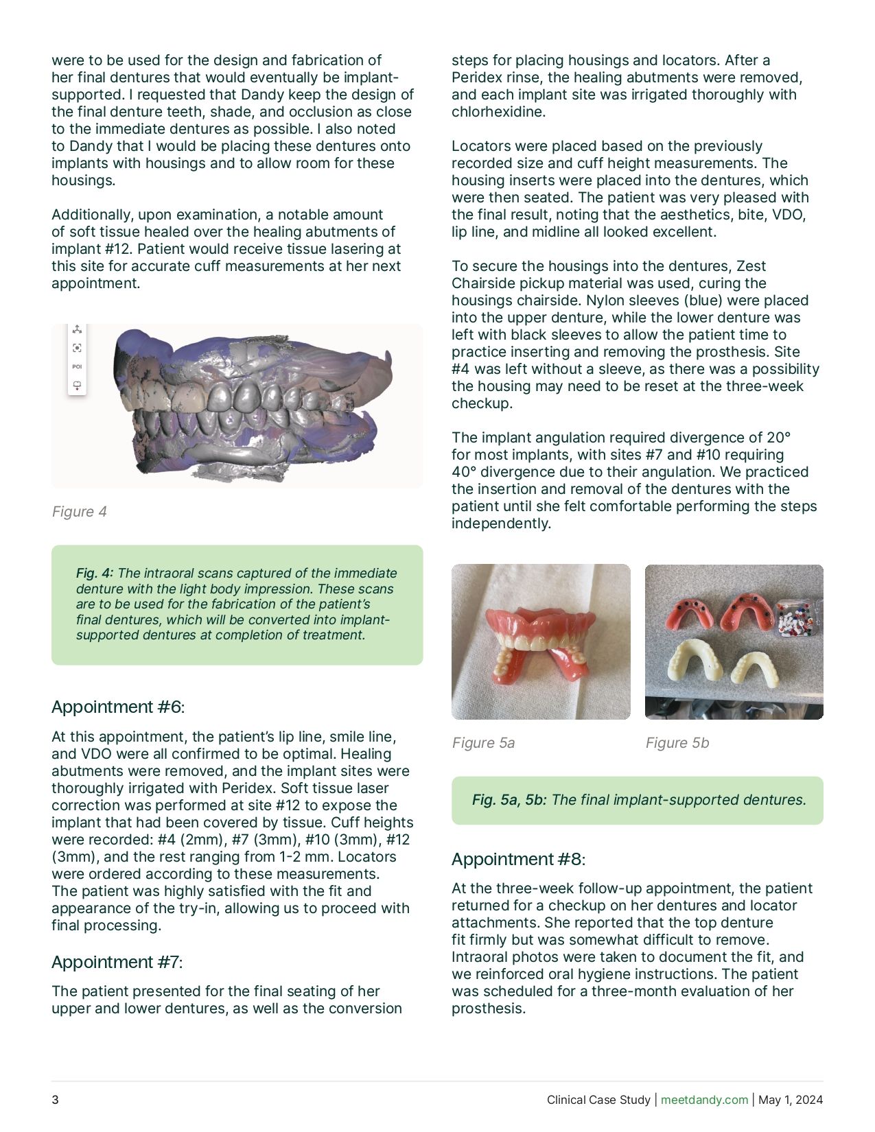 A Fully Restored Smile - From Immediate to Implant-Supported Dentures