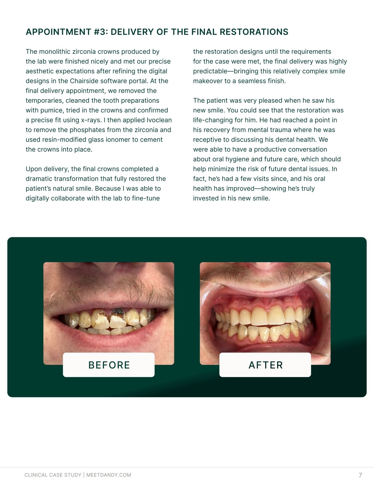 Case Study: Simplifying Smile Makeovers with Digital