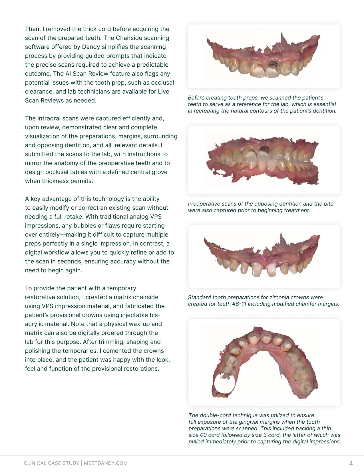 Case Study: Simplifying Smile Makeovers with Digital