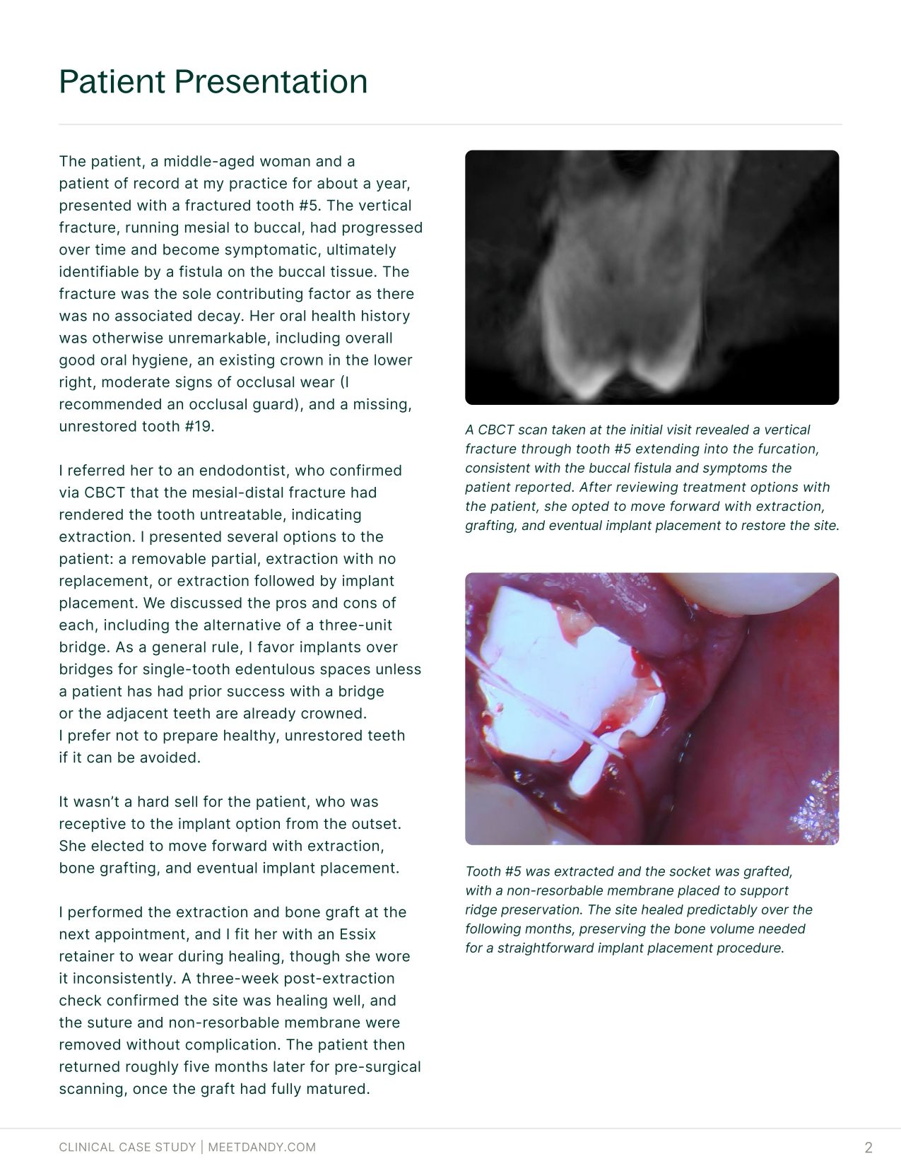 Case Study: Surgical Guides with Dr. Haley