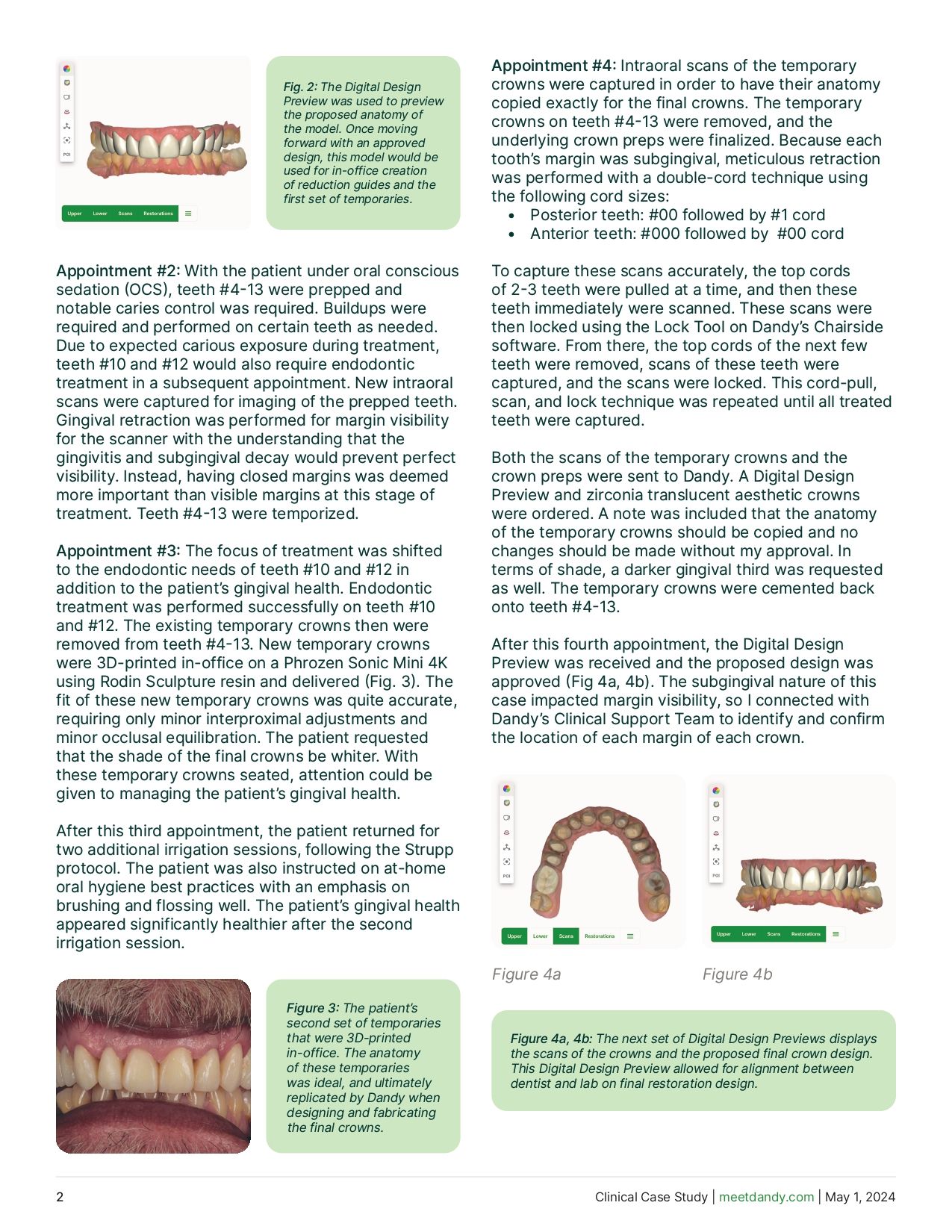 Precision in practice: Digital dentistry for full arch cosmetic cases