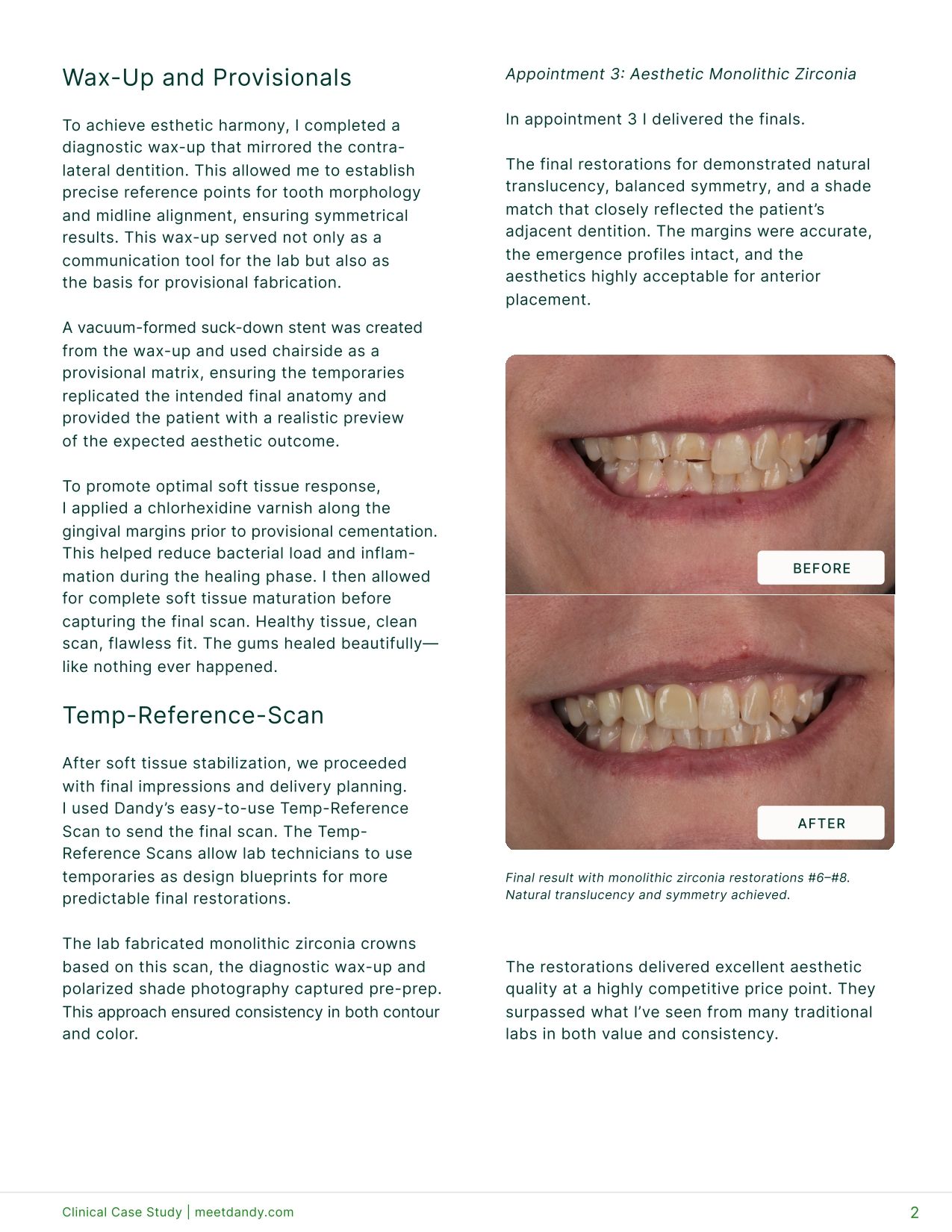 Restoring Anterior Aesthetics After Trauma