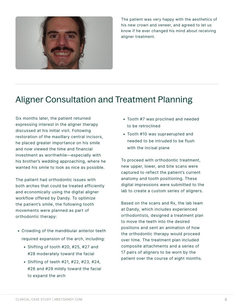 Precision-Driven Crown and Aligner Care