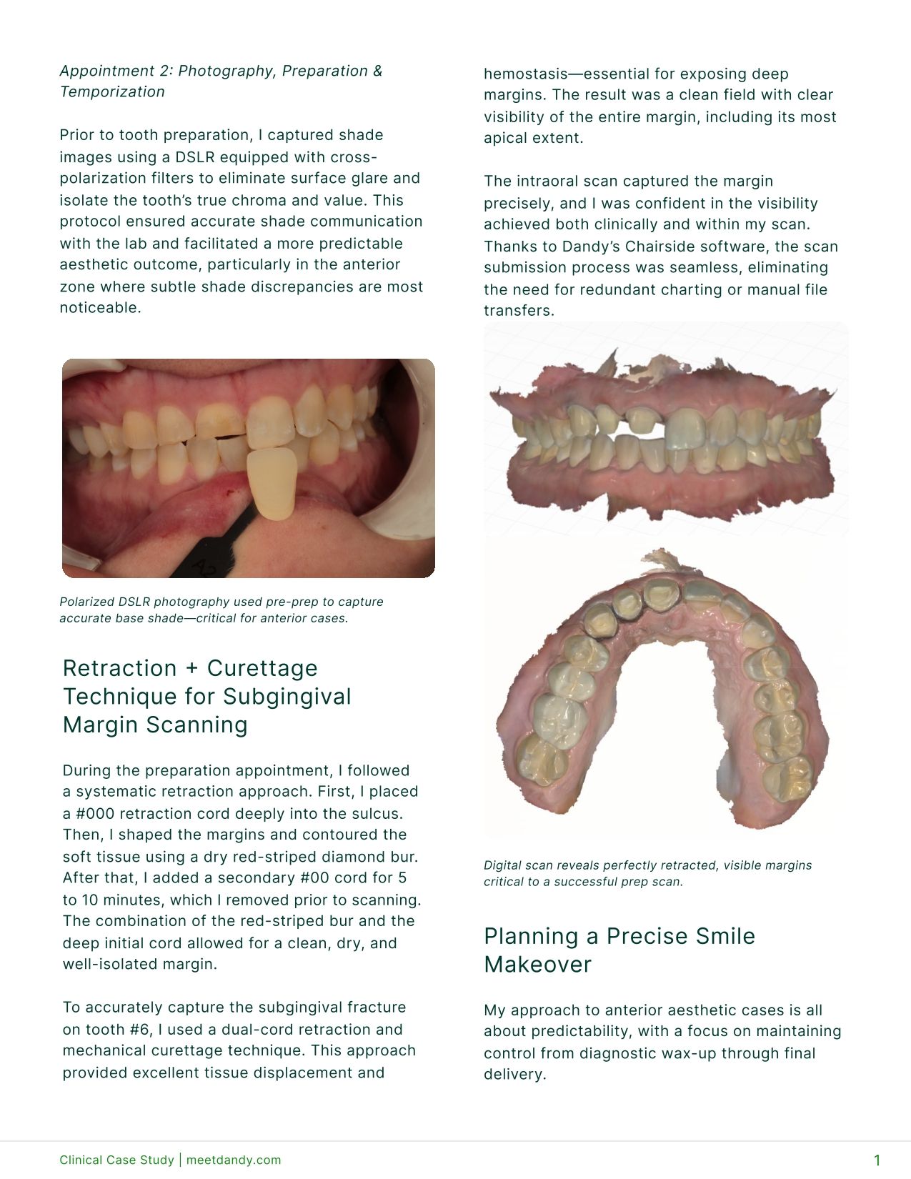 Restoring Anterior Aesthetics After Trauma