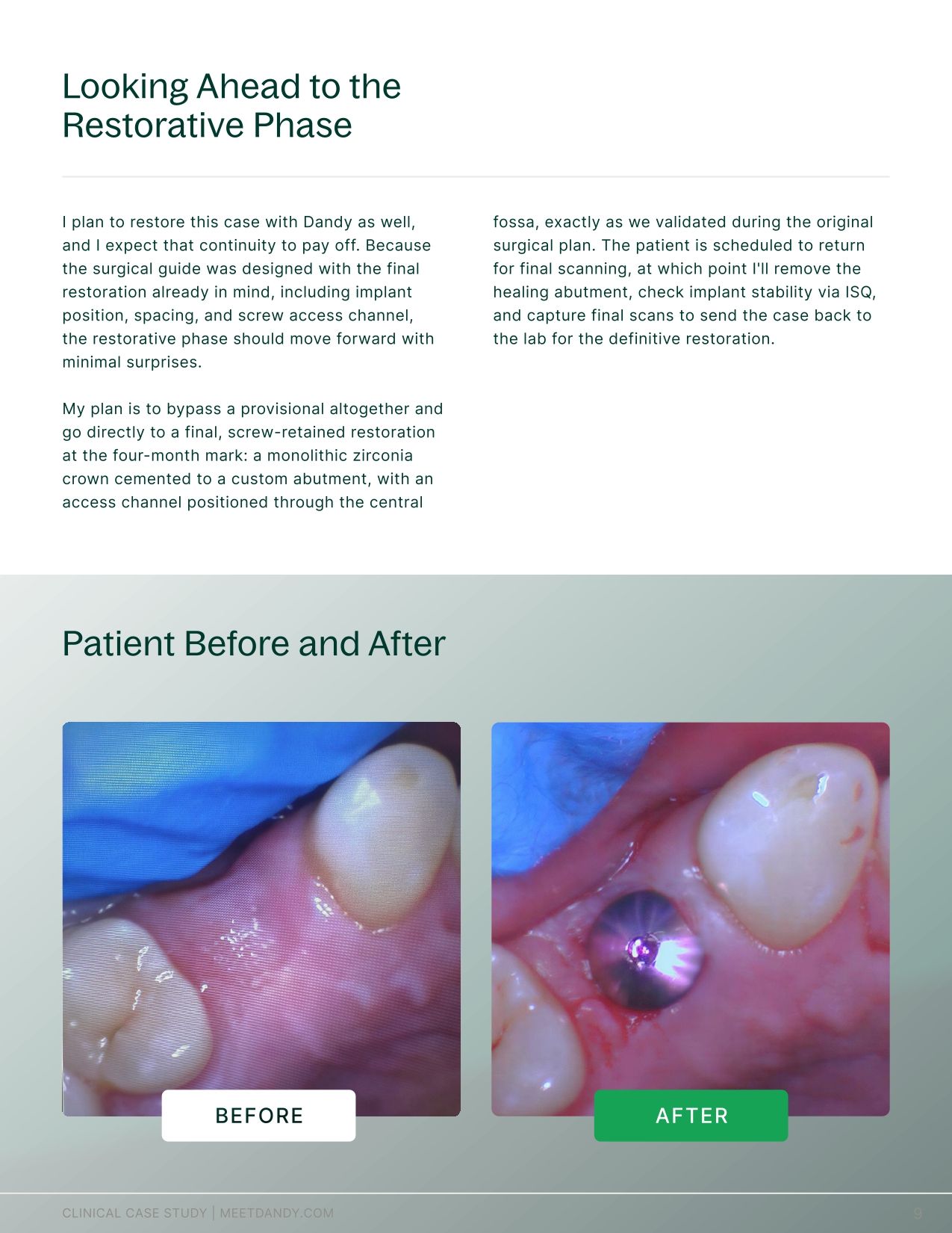 Case Study: Surgical Guides with Dr. Haley