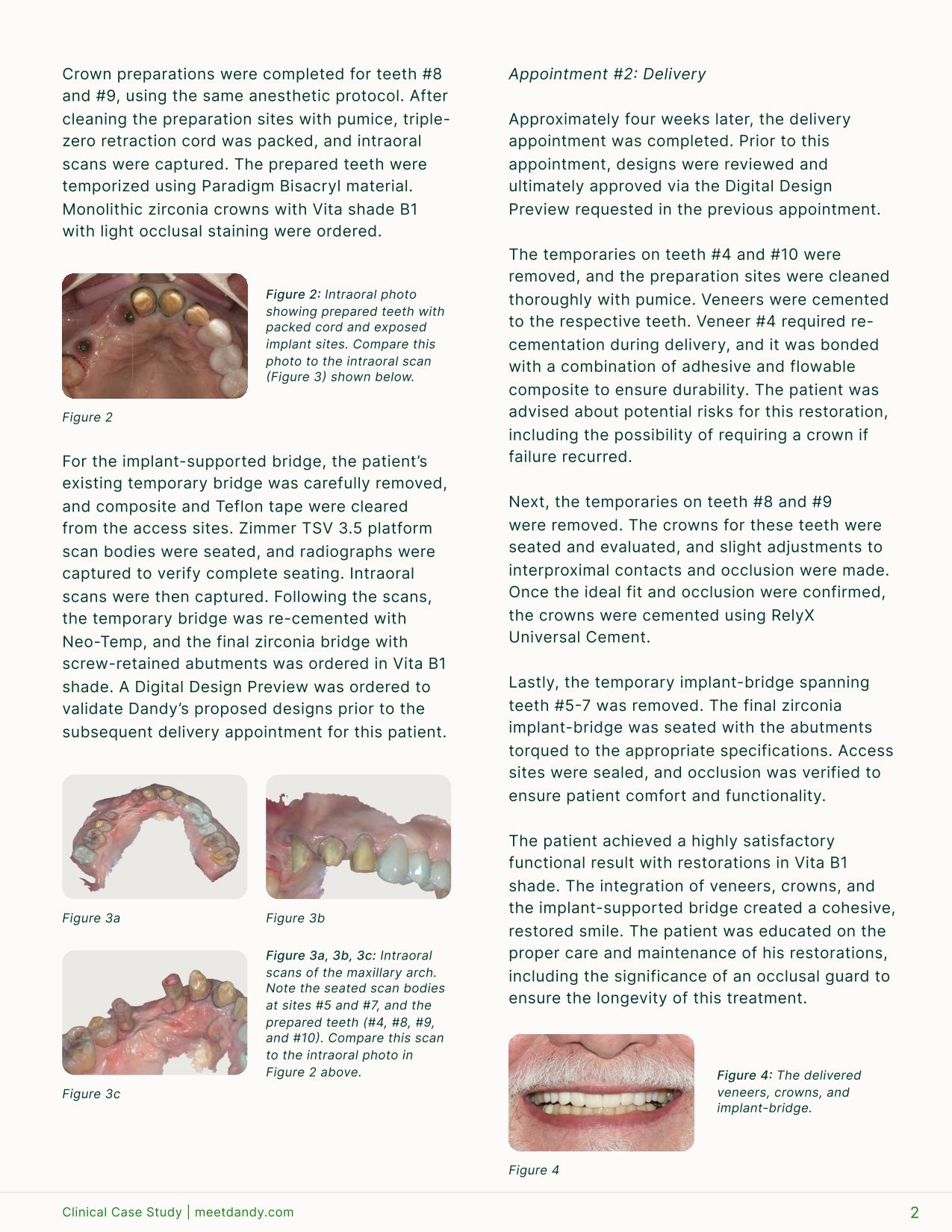 Comprehensive Restorative Care with Veneers, Crowns, and Implants