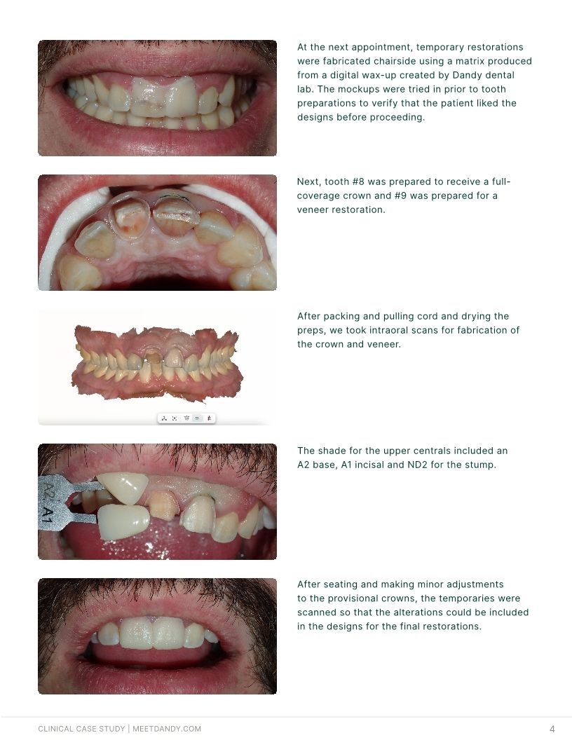 Precision-Driven Crown and Aligner Care