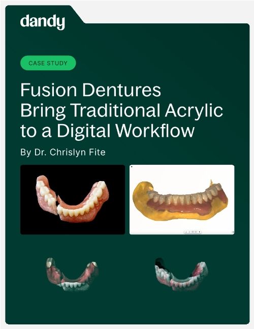 Case Study: Fusion Dentures Bring Traditional Acrylic to a Digital Workflow