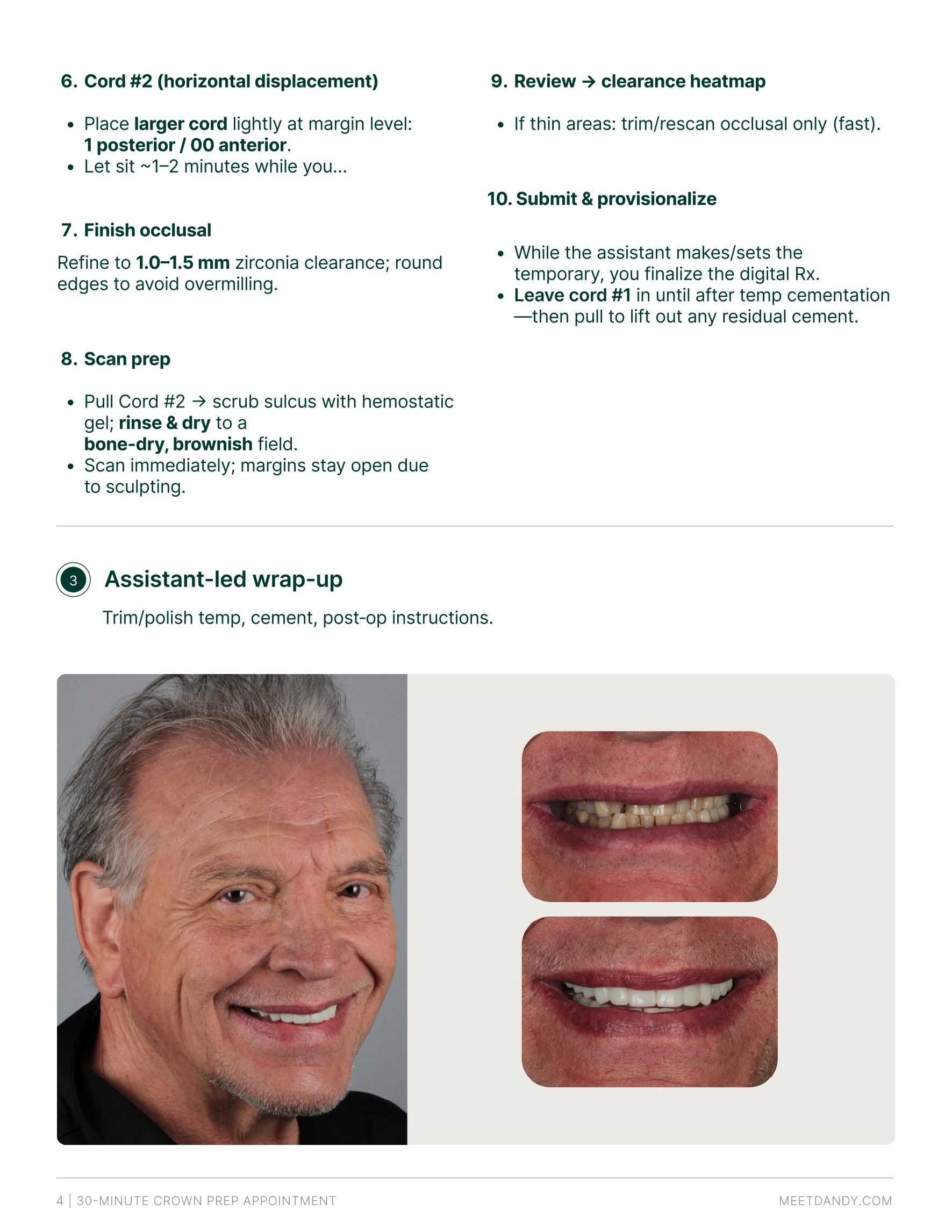 30-Minute Crown Prep Appointment