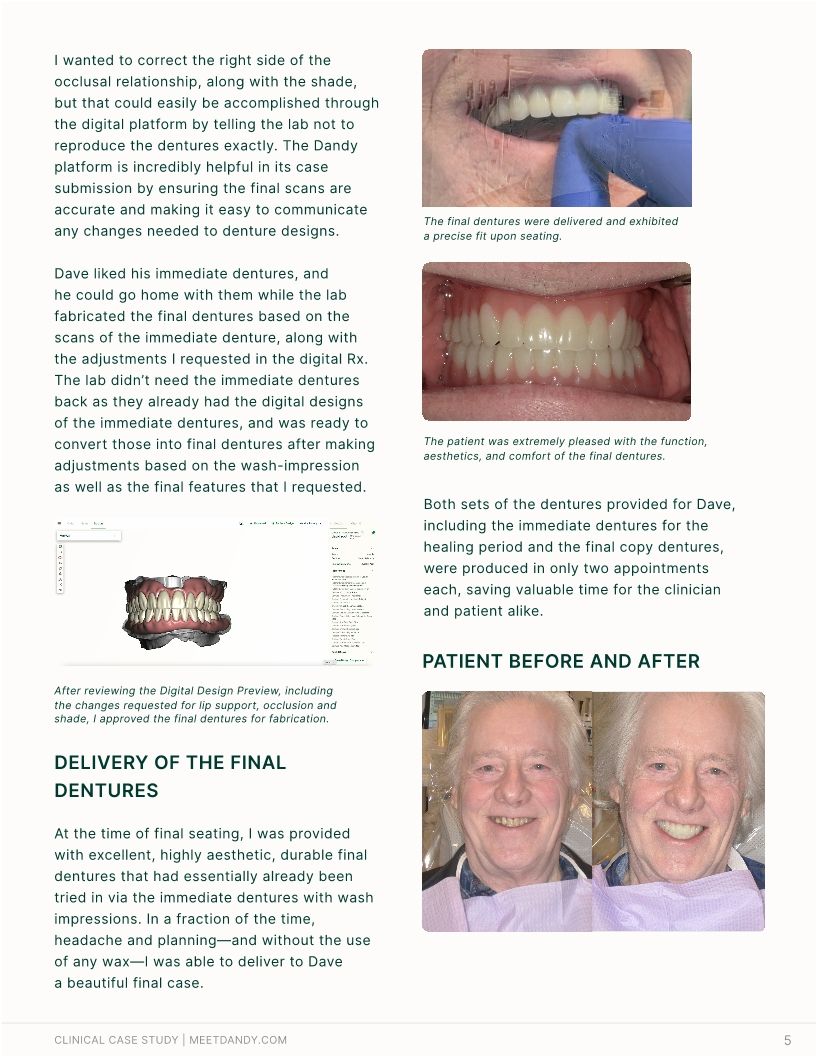 2-Appt Denture Protocol