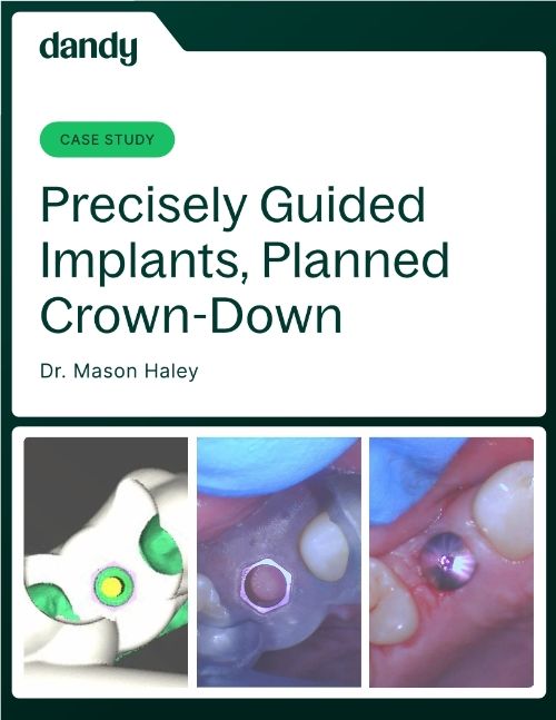 Case Study: Surgical Guides with Dr. Haley