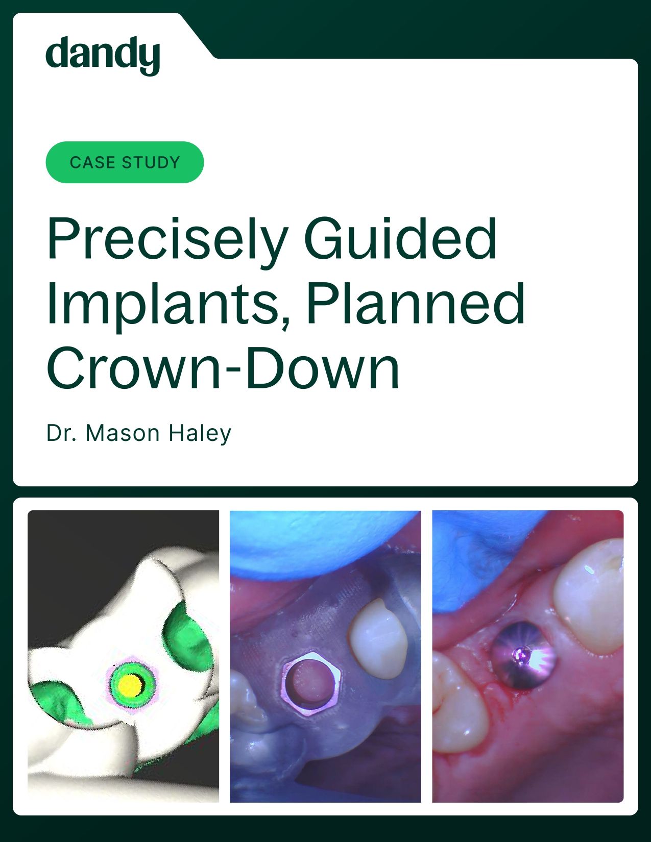 Case Study: Surgical Guides with Dr. Haley