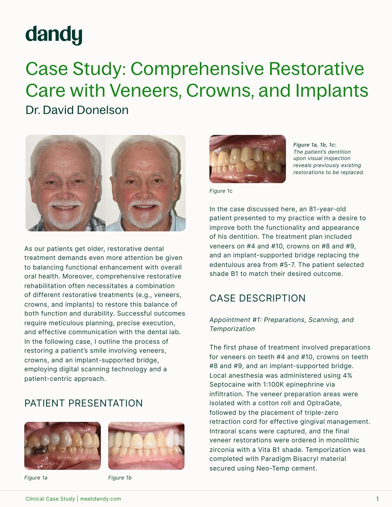 Comprehensive Restorative Care with Veneers, Crowns, and Implants