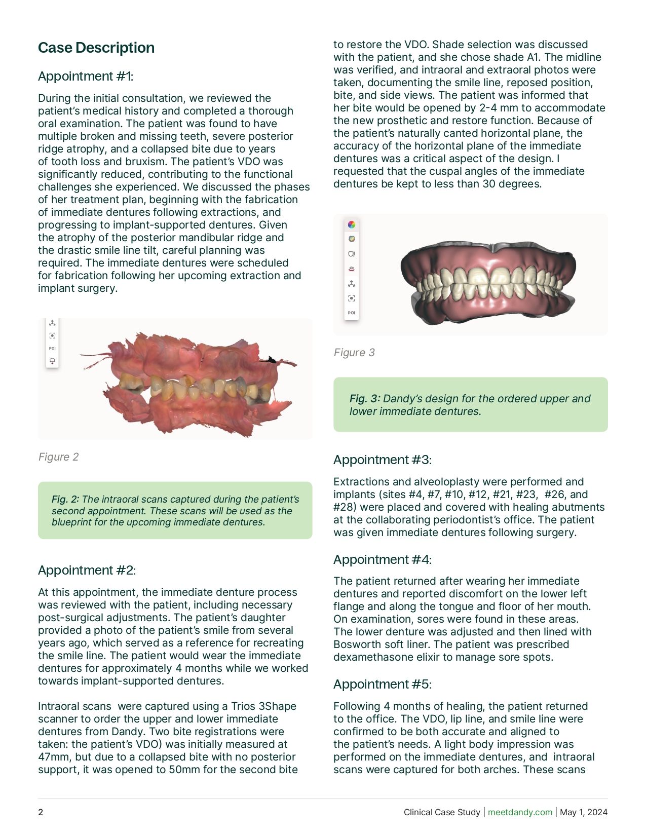 A Fully Restored Smile - From Immediate to Implant-Supported Dentures