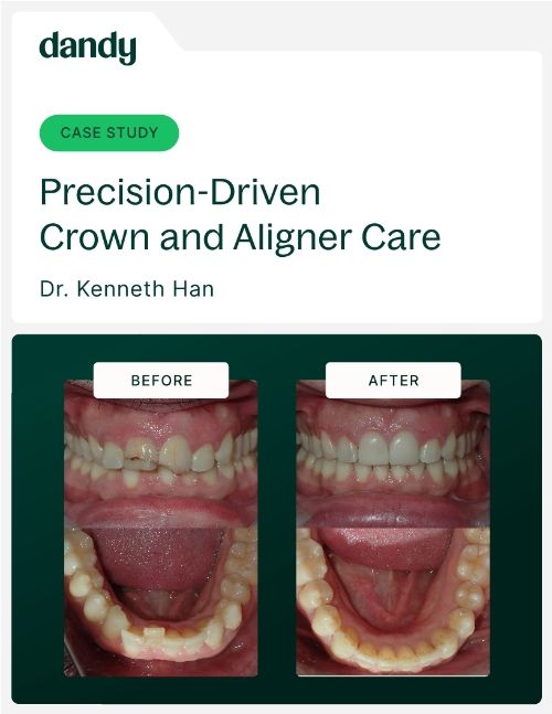 Precision-Driven Crown and Aligner Care