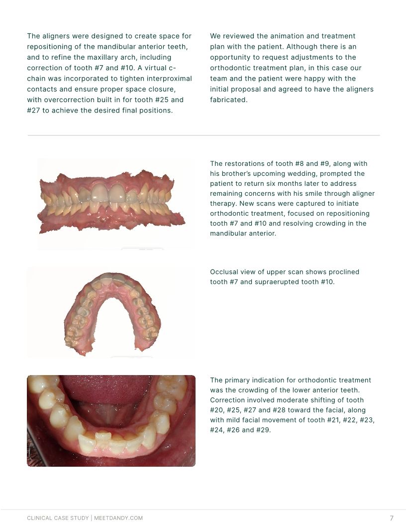 Precision-Driven Crown and Aligner Care