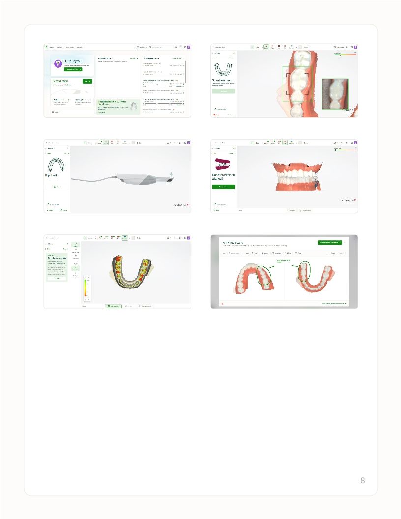 Diagnostic Scans: A gateway for more dental treatments