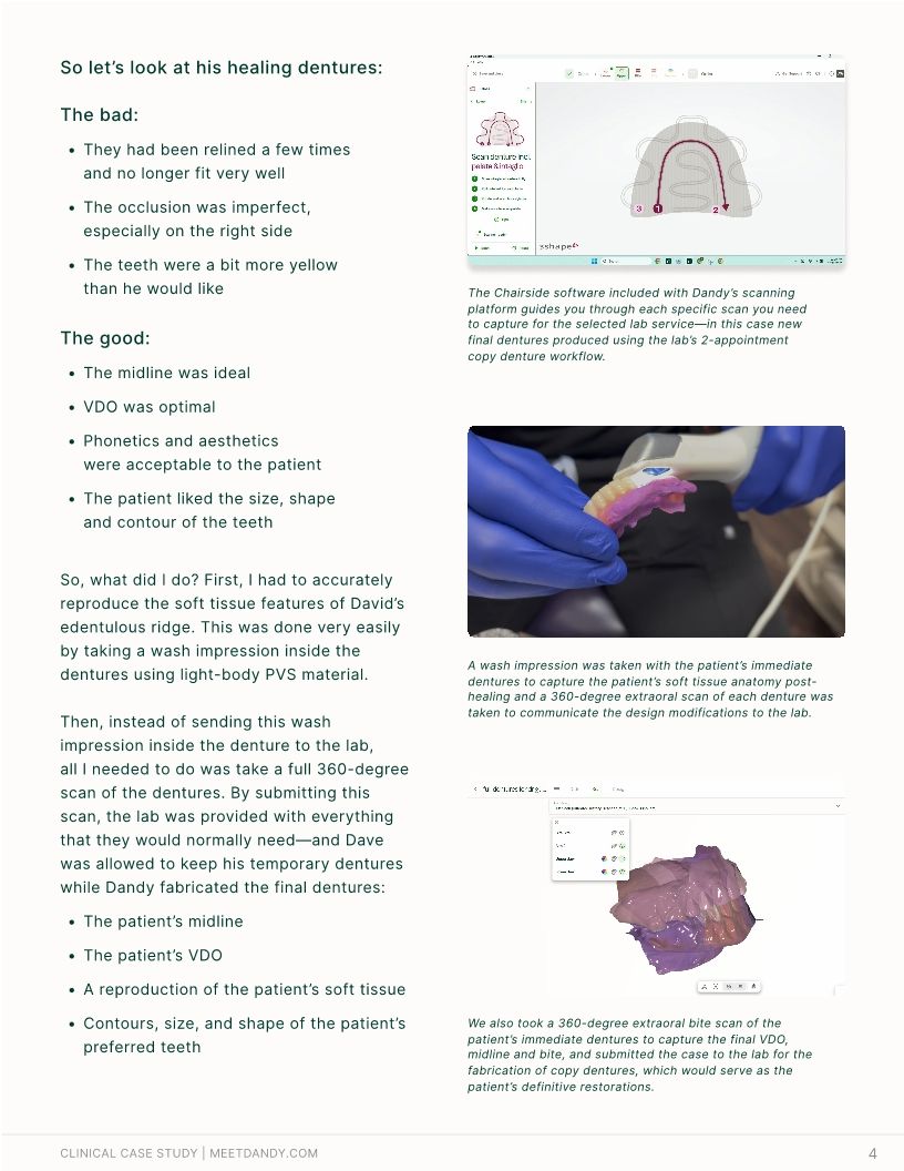 2-Appt Denture Protocol