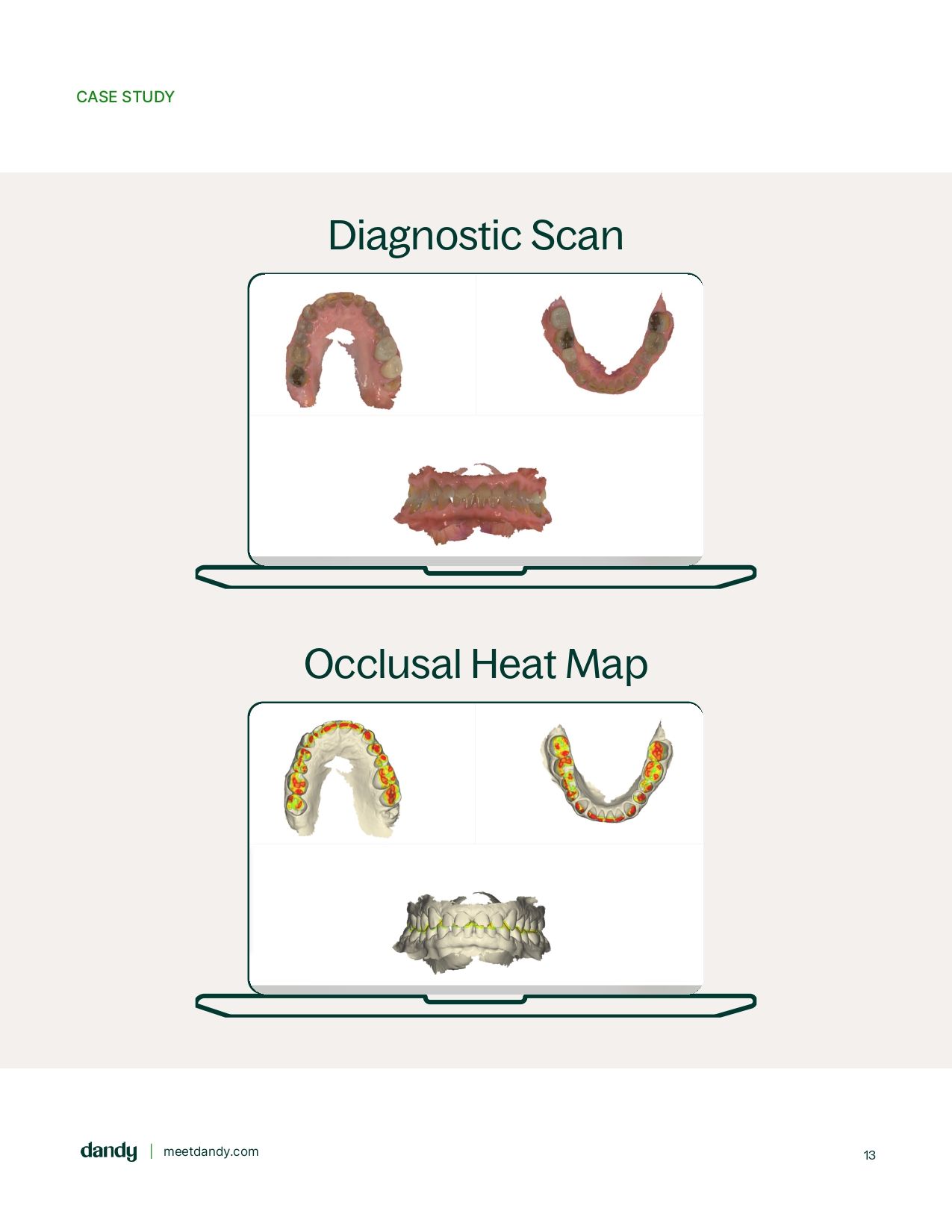 The ultimate guide to Diagnostic Scans
