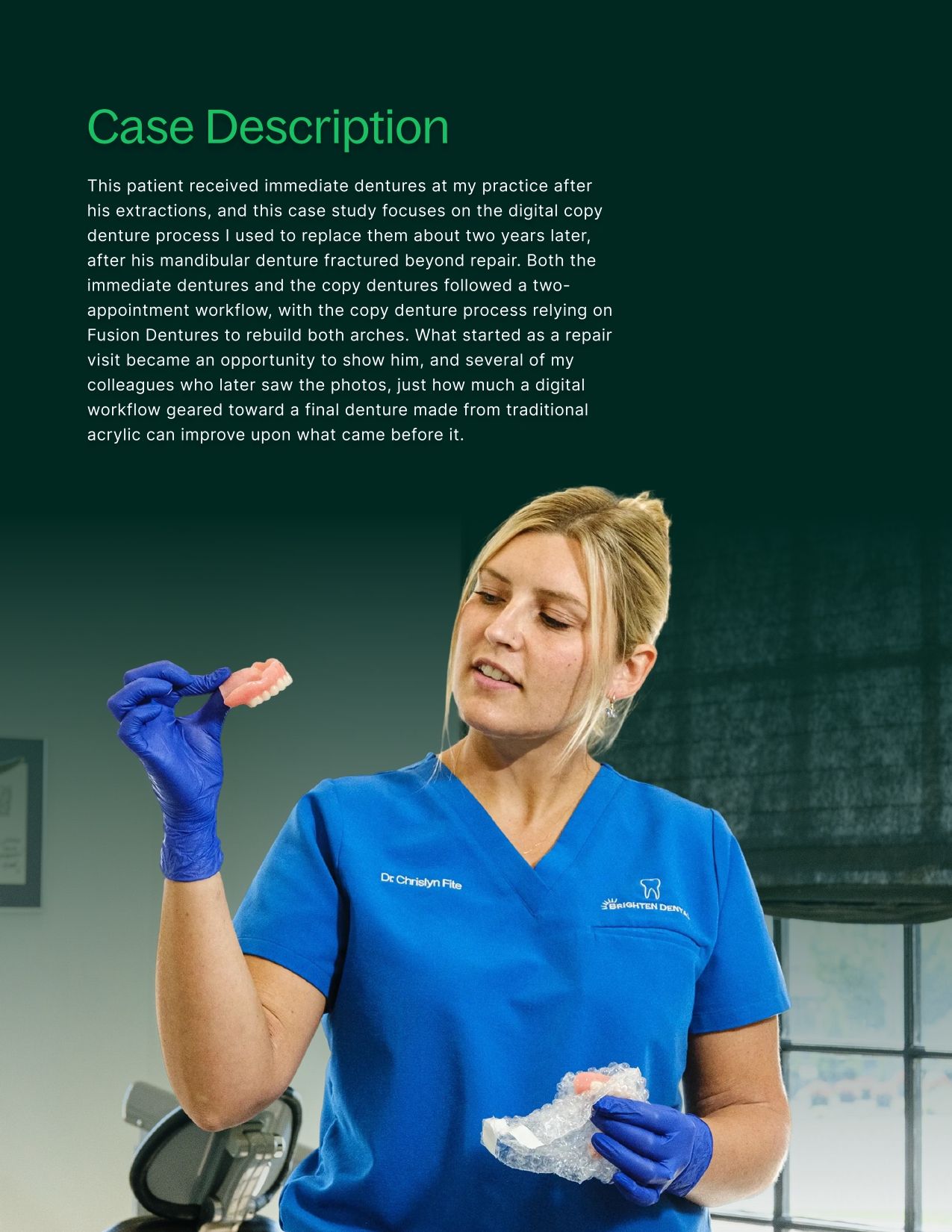 Case Study: Fusion Dentures Bring Traditional Acrylic to a Digital Workflow