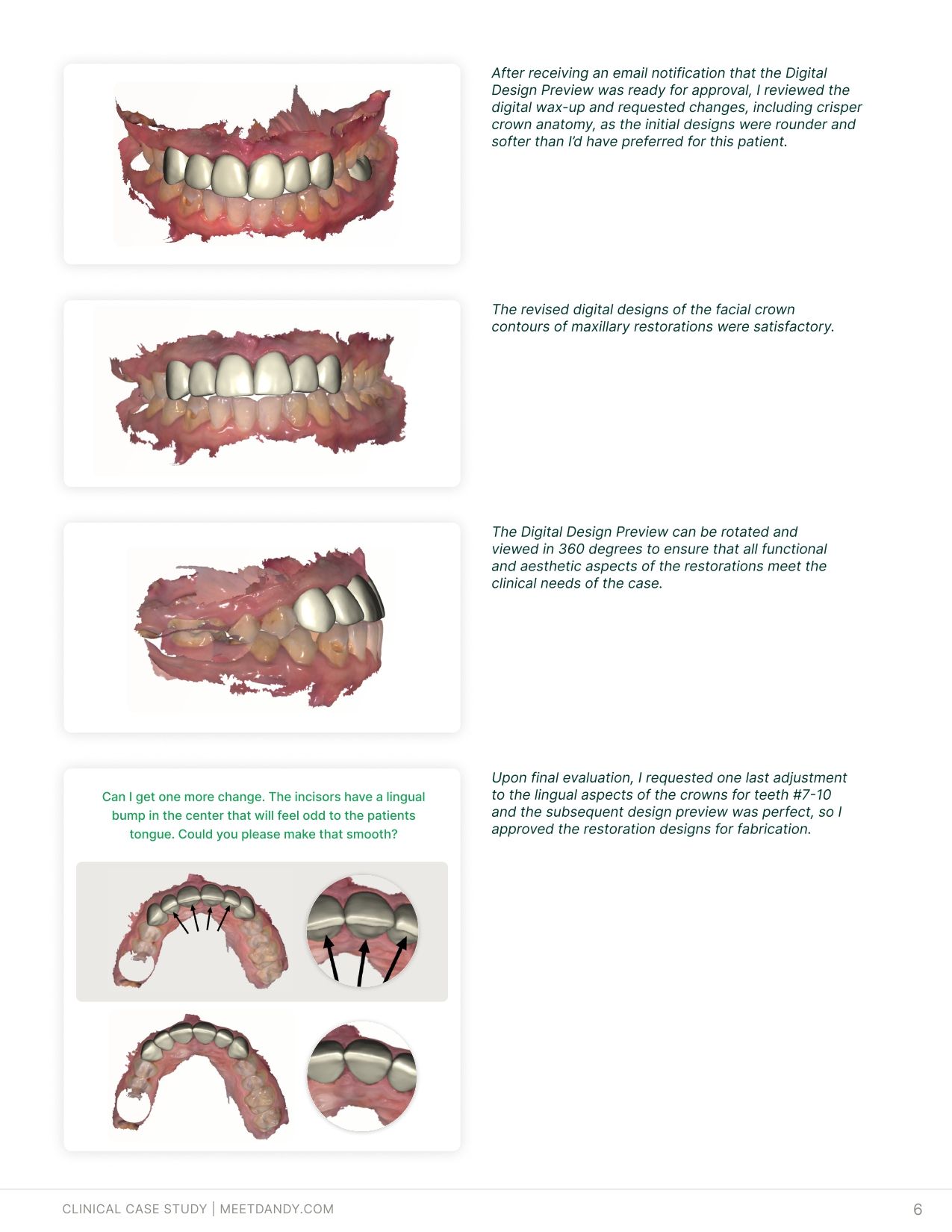 Case Study: Simplifying Smile Makeovers with Digital