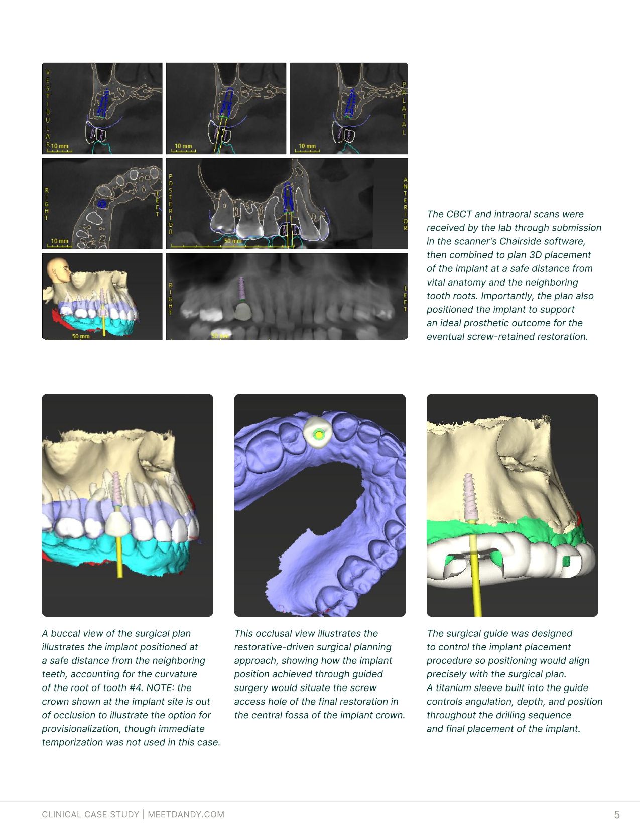 Case Study: Surgical Guides with Dr. Haley