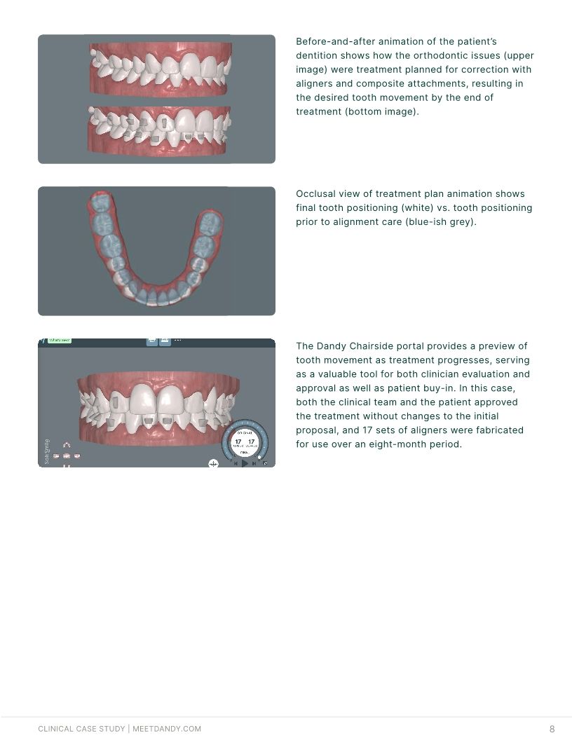 Precision-Driven Crown and Aligner Care