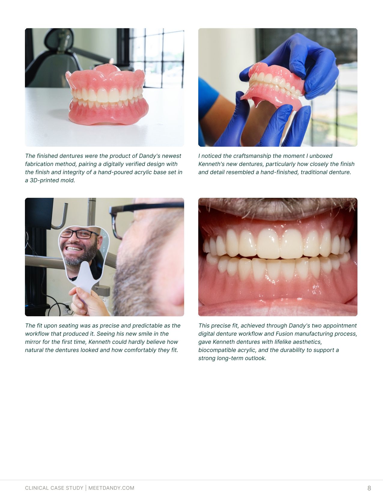 Case Study: Fusion Dentures Bring Traditional Acrylic to a Digital Workflow
