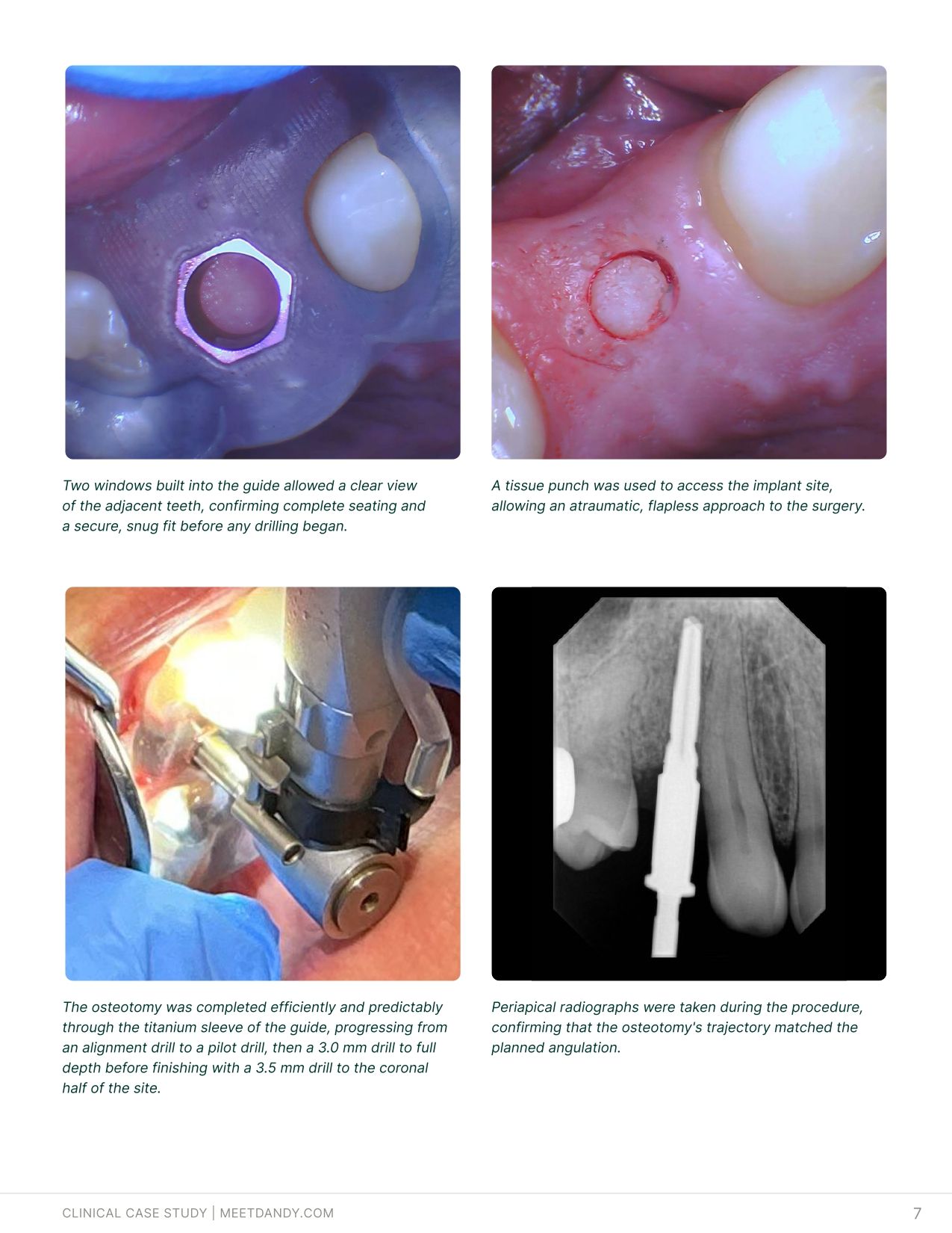 Case Study: Surgical Guides with Dr. Haley
