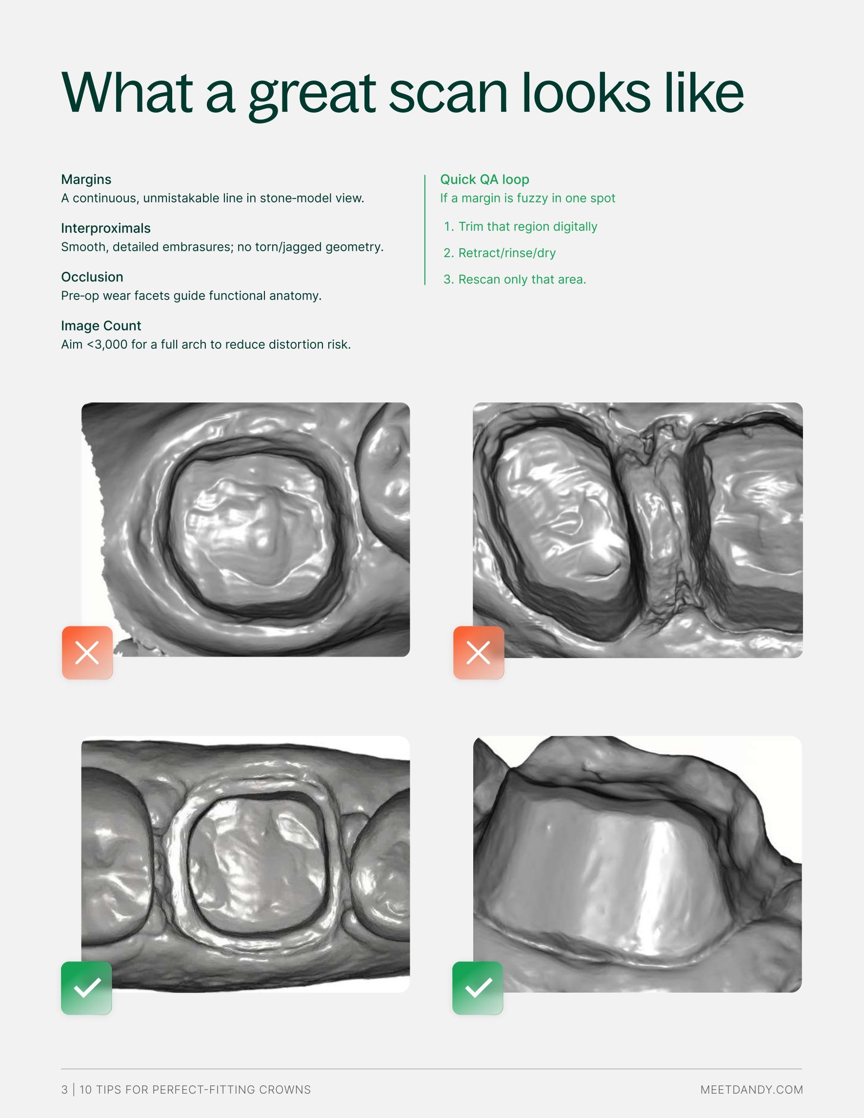 10 Tips Perfect Crowns