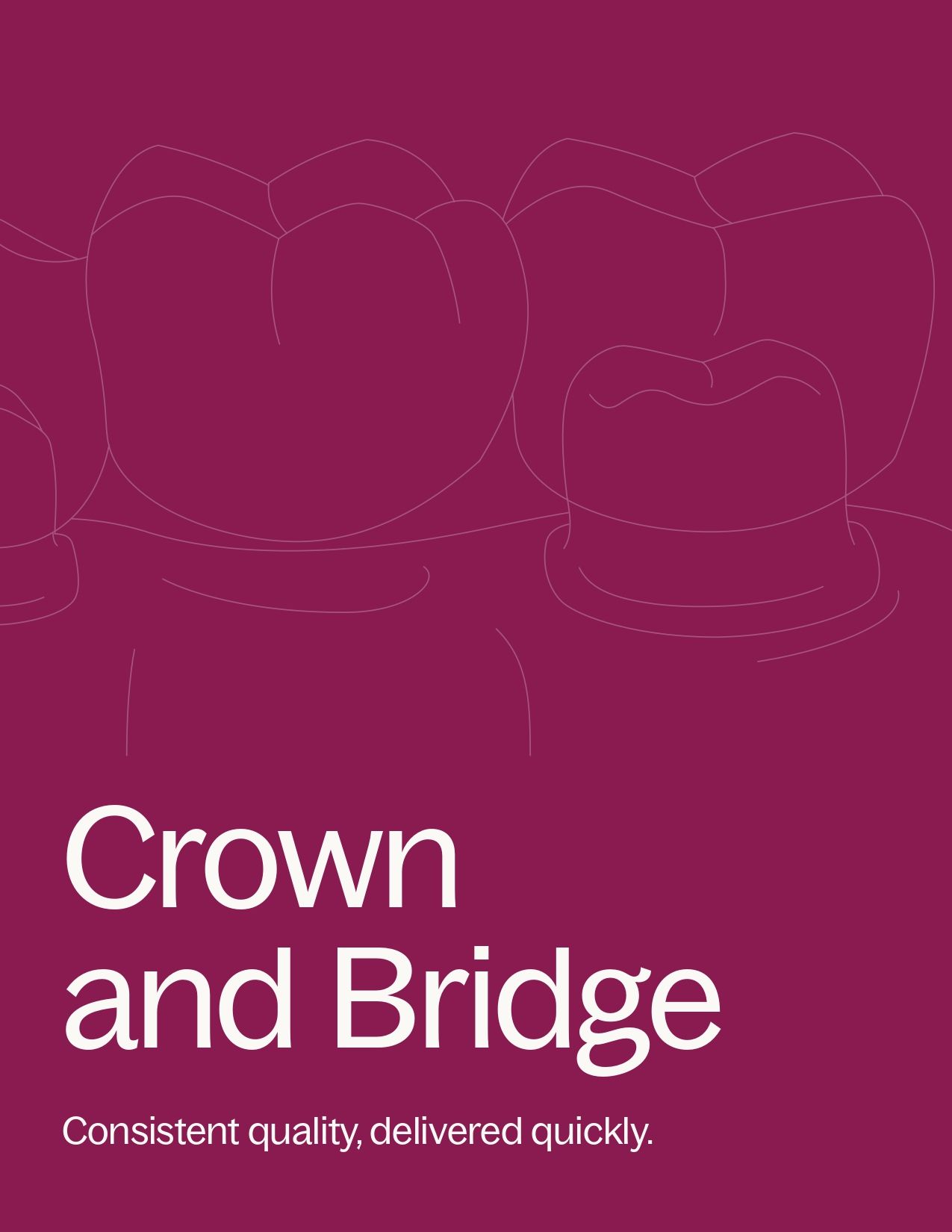 Crown and Bridge Product Guide