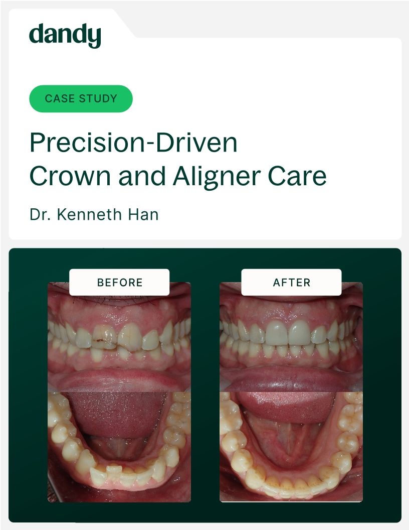 Precision-Driven Crown and Aligner Care