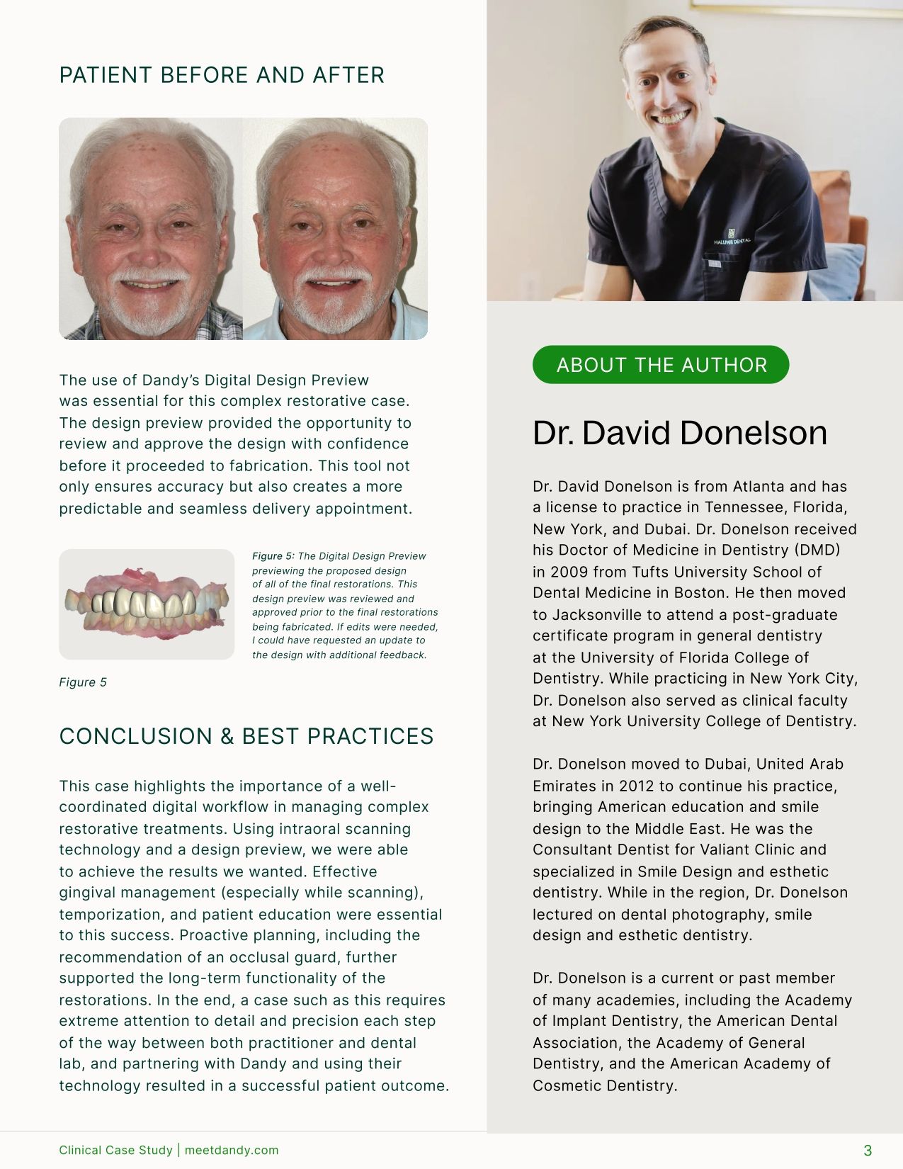 Comprehensive Restorative Care with Veneers, Crowns, and Implants