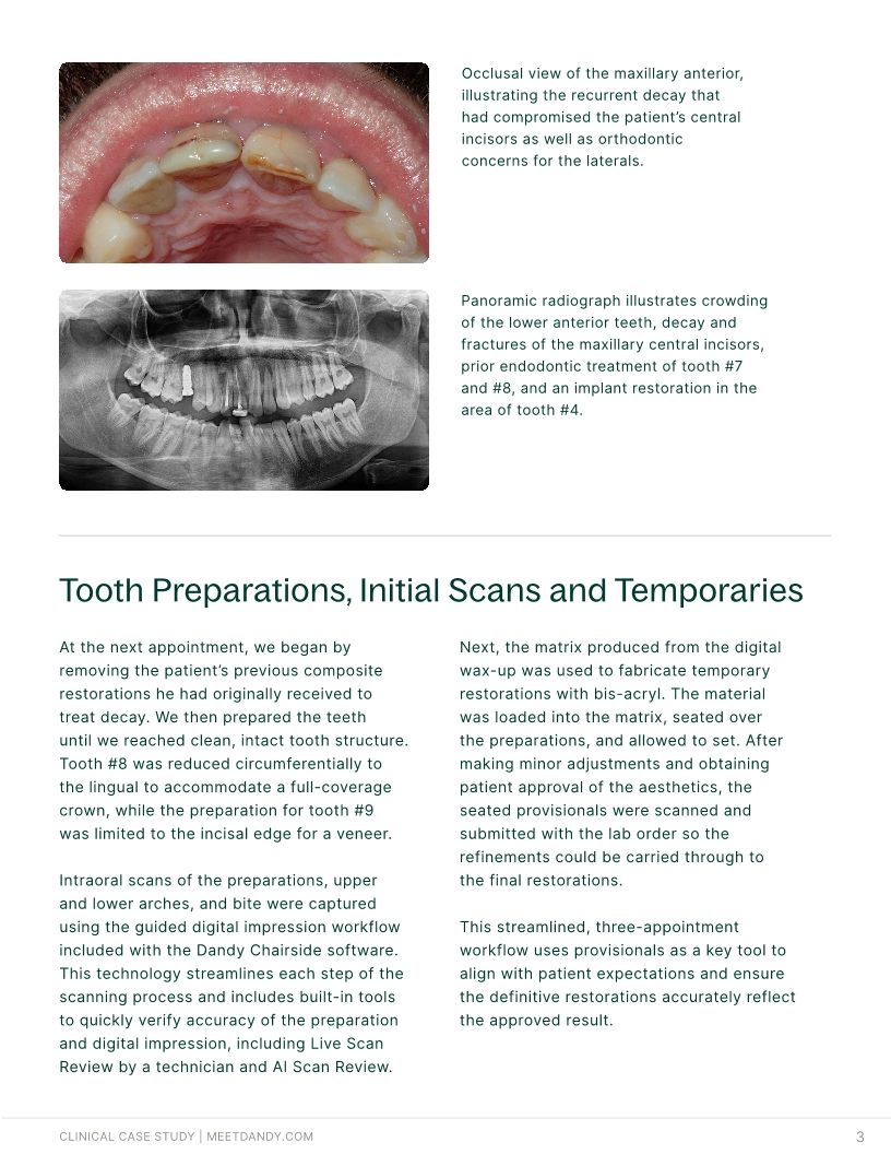 Precision-Driven Crown and Aligner Care