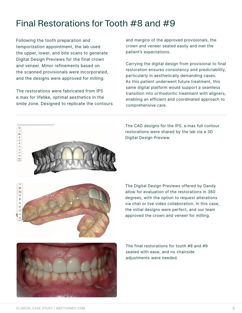 Precision-Driven Crown and Aligner Care
