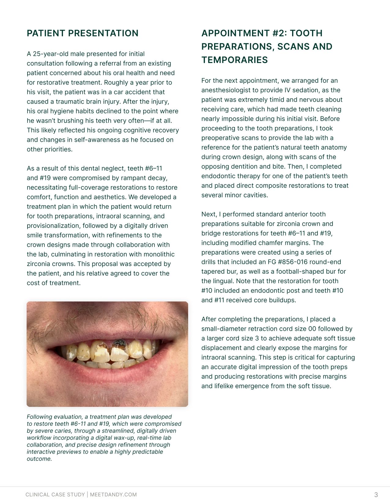 Case Study: Simplifying Smile Makeovers with Digital