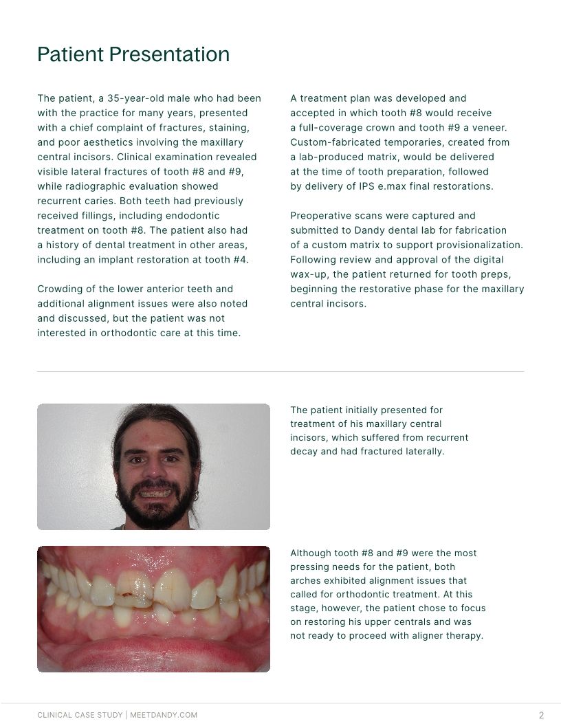 Precision-Driven Crown and Aligner Care